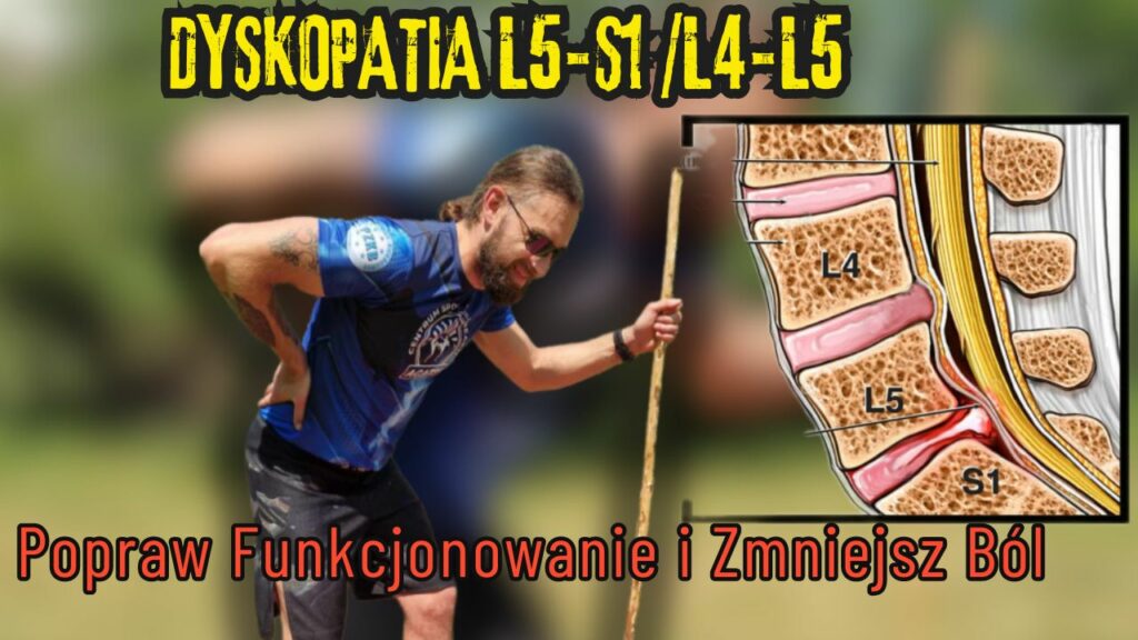 Ćwiczenia na Dyskopatię L4-L5 i L5-S1 : Popraw Funkcjonowanie i Zmniejsz Ból